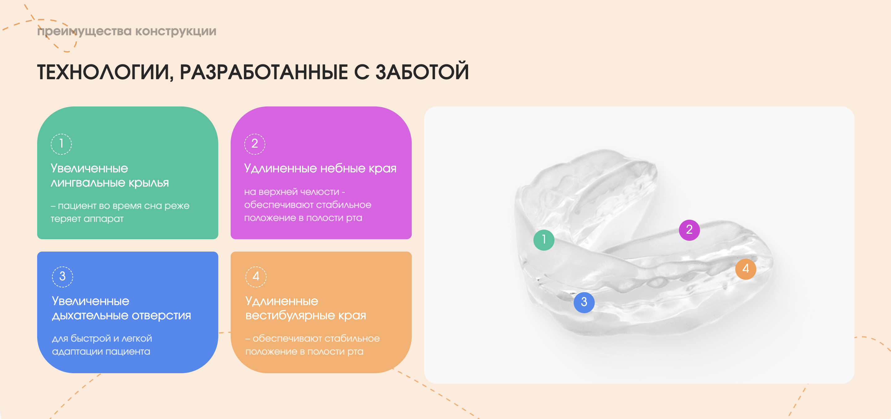 Блок «Преимущества конструкции»: четыре цветные скругленные карточки и фото аппарата с нумерованными метками